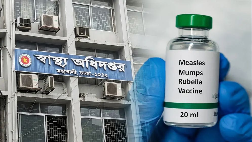 হাম উপসর্গে আরও একজনের মৃত্যু, নতুন আক্রান্ত ১ হাজার ১০